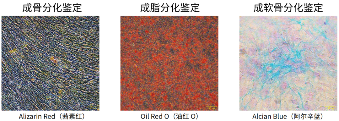 新品上市 | 妙顺生物X元戊医学新推出i-MSC细胞产品(图3)