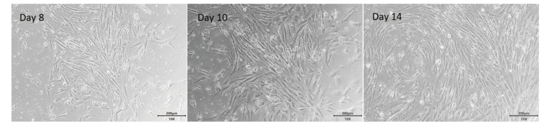 新品上市 | 解离的肿瘤原代细胞(DTCs)分离冻存服务(图2)